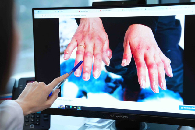 Soğuk havalarda uzuv kaybına karşı önleminizi alın - Resim: 0